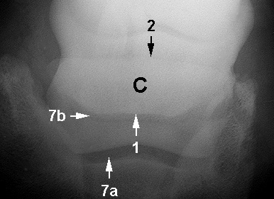 Radiograph of the Dorsoproximal-palmar(plantar)odistal oblique view