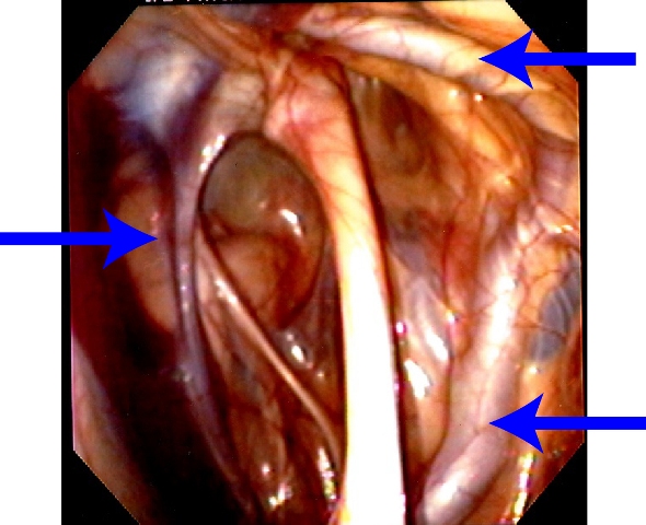 Guttural pouch anatomy