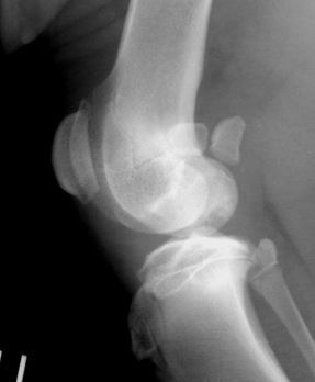 Radiograph showing Left stifle. Lateral oblique view.