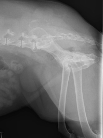 Osteosarcoma of the ilial wing
