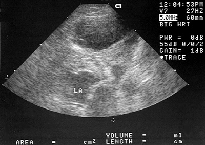 Ultrasonographic image of the pulmonary mass