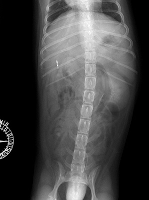 Radiograph of the Intravenous pyelogram - pyelogenic phase - ventrodorsal view