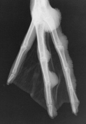 Radiograph of the Left DMPL oblique view