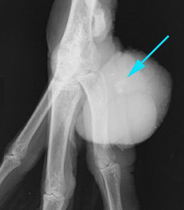 Radiograph of the Right DMPL oblique view