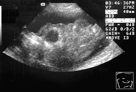 Ultrasound showing the Cranial mediastinum