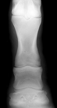 Radiograph of the Dorsopalmar view - right front pastern