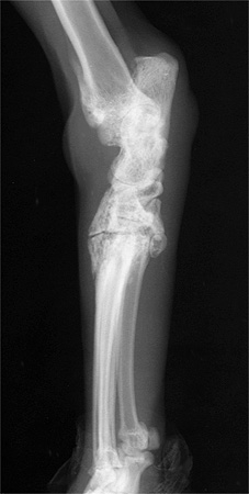 Radiograph of the Right DMPL oblique view