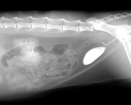 Radiograph of the Lateral View - Pyelogenic Phase