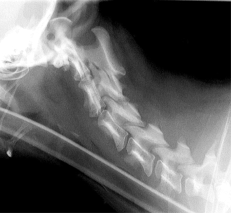 Radiograph of the Right Lateral View of Cervical Spine